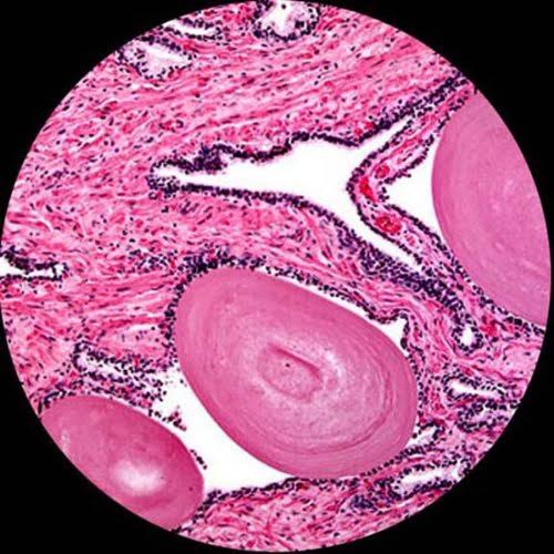 40X-1000X LED Cordless All-Metal Compound Microscope R923165